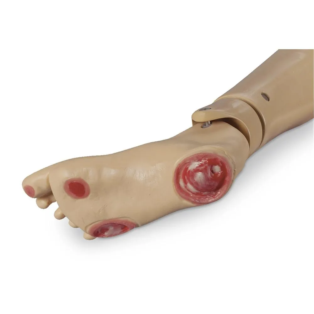 Pressure Ulcer Foot for GERi™-KERi™, Light